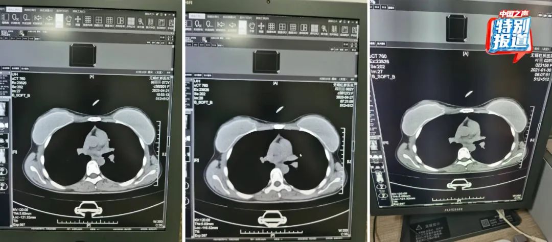 一张CT片子套多个病历?无锡虹桥医院涉嫌骗保,医生实名举报!
