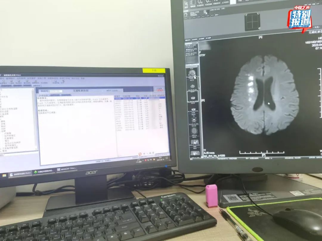 一张CT片子套多个病历?无锡虹桥医院涉嫌骗保,医生实名举报!