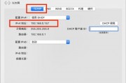 电脑怎么设置ip自动获取(电脑怎样设置ip为自动获取)