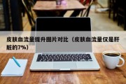 皮肤血流量提升图片对比（皮肤血流量仅是肝脏的7%）